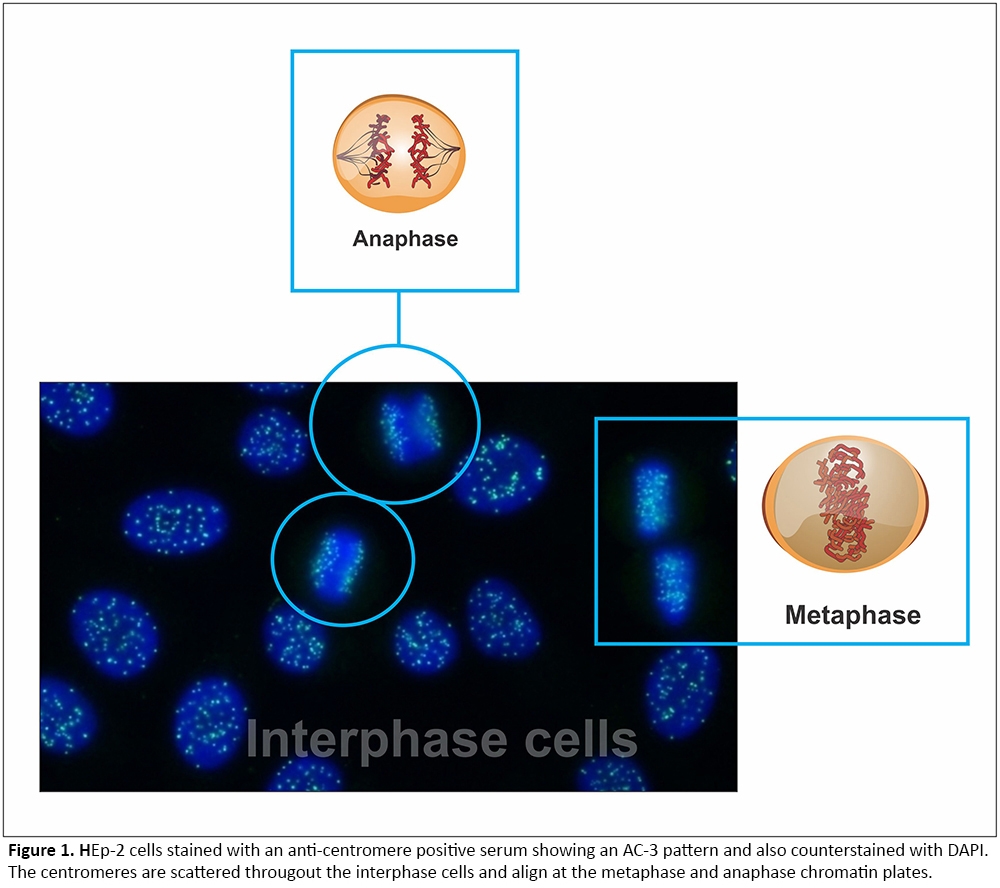 ANA Patterns ANA Patterns