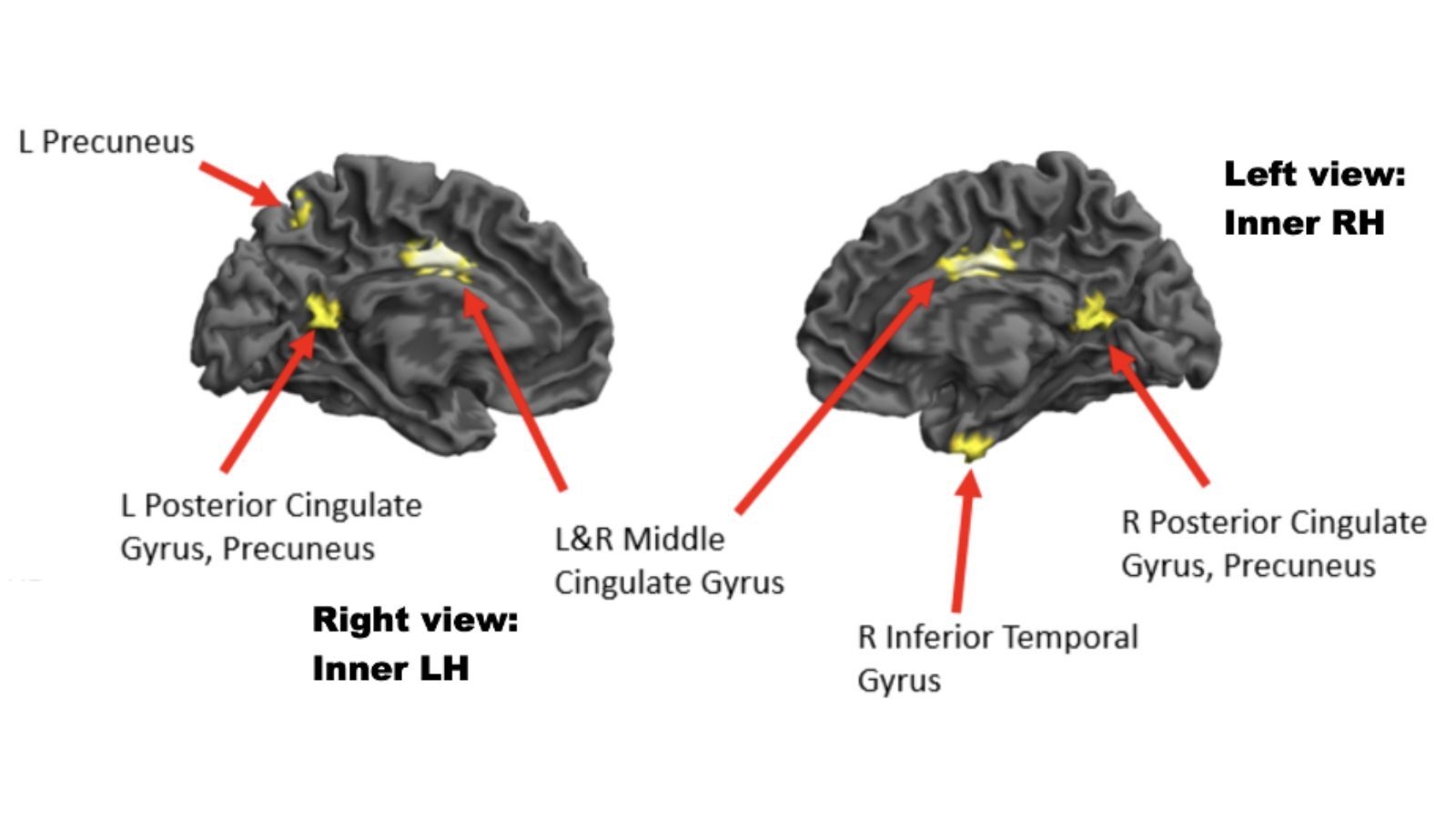 Flow State Uncovered We Finally Know What Happens In The Brain When You re in The Zone Live Science Flow State Uncovered We Finally Know What Happens In The Brain When You re in The Zone Live Science
