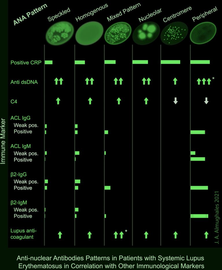Frontiers Anti Nuclear Antibodies Patterns In Patients With Systemic Lupus Erythematosus And Their Correlation With Other Diagnostic Immunological Parameters
