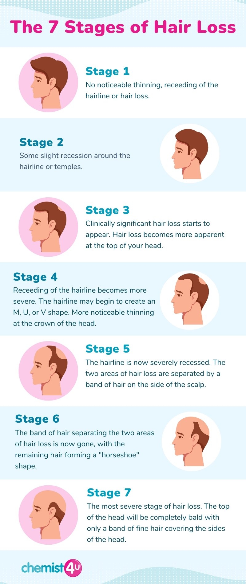 Male Pattern Baldness Treatment And Causes Guides Male Pattern Baldness Treatment And Causes Guides