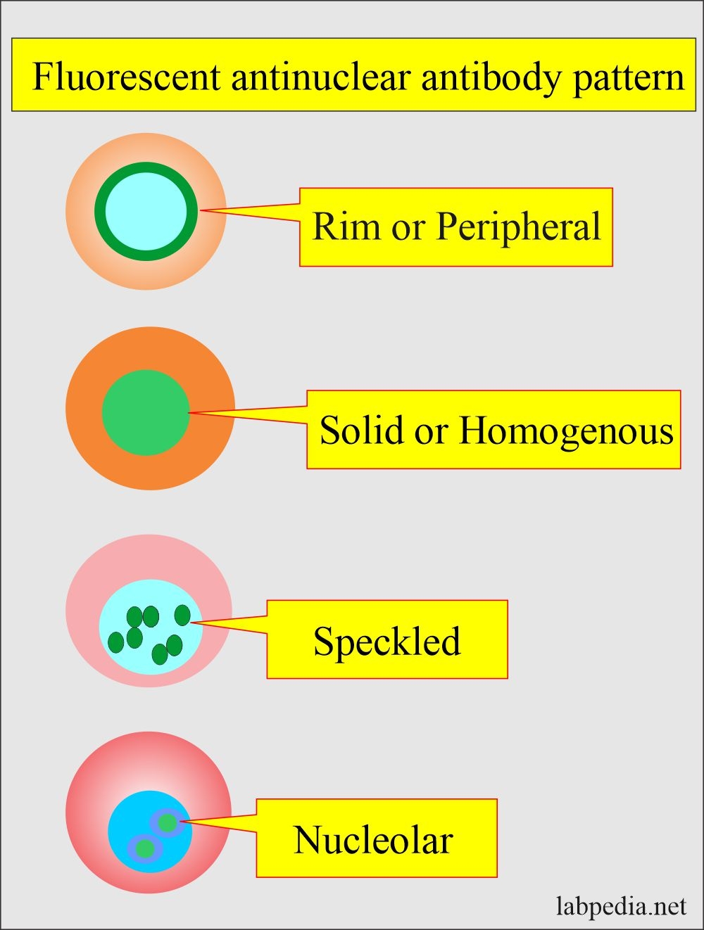 Nuclear Homogeneous Ana Pattern Www lx iriss uk Nuclear Homogeneous Ana Pattern Www lx iriss uk