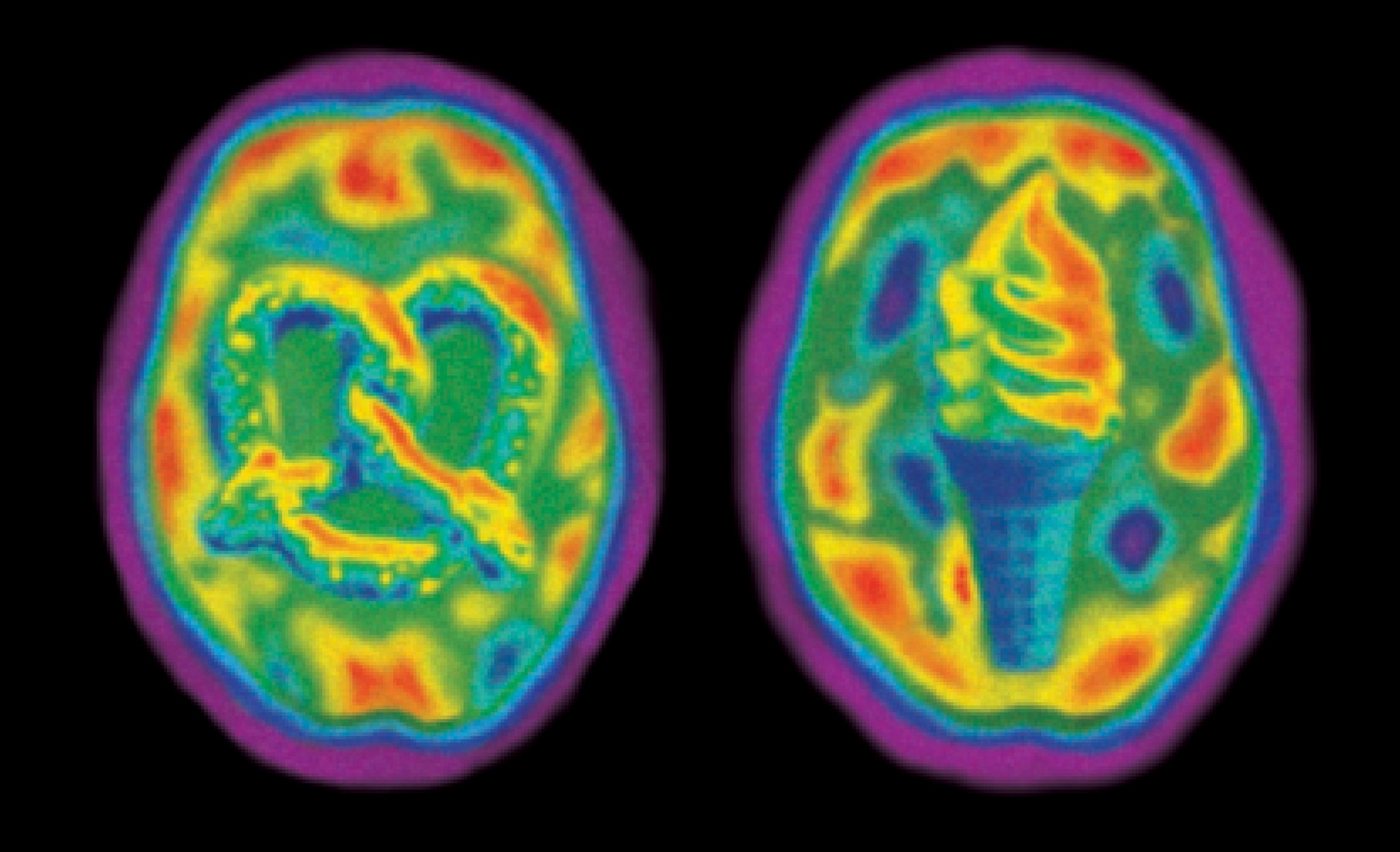 brain activity scan crossword clue brain activity scan crossword clue
