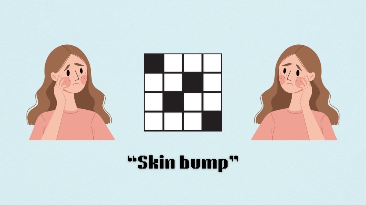 Skin Bump NYT Mini Crossword Puzzle Clue Aug 28 Answer And Hints Skin Bump NYT Mini Crossword Puzzle Clue Aug 28 Answer And Hints