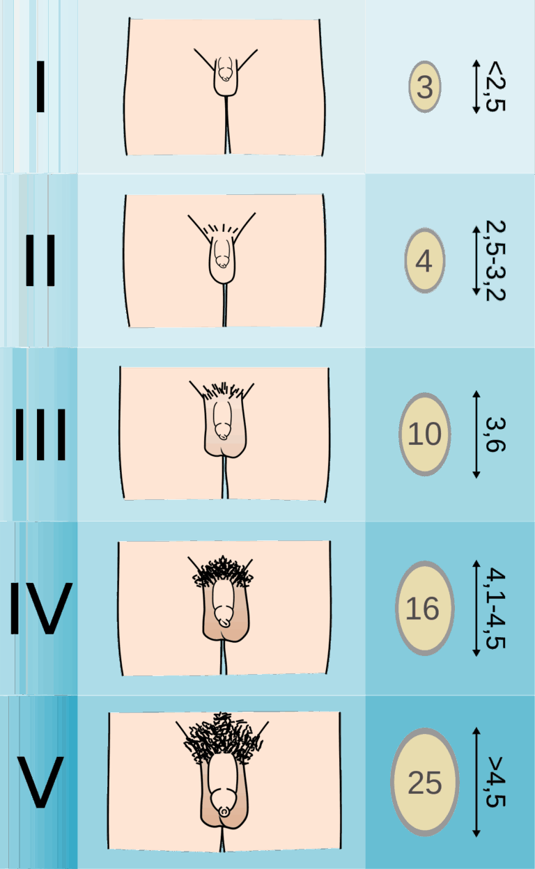 Tanner Scale Wikipedia